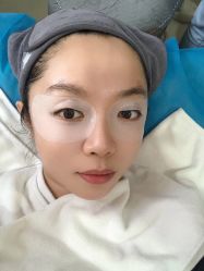 体验后-天津健丽·去眼袋医疗美容机构