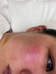 -铂特丽医美·眼鼻整形·光电美肤·注射抗衰
