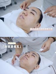 -悟空祛痘·诺奖技术专业店