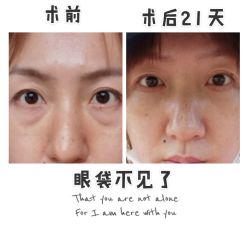 体验前-八大处整形