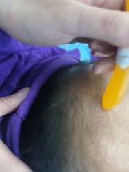 -蕾特恩专业祛痘·皮肤管理