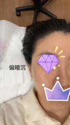 体验前-澳玛·星光医疗美容