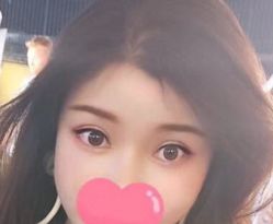 -大麦微针植发全国连锁