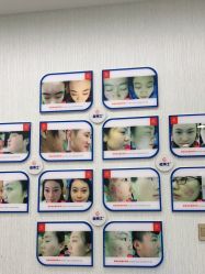 -悟空祛痘·诺奖技术专业店