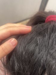 -熙朵美学植发·连锁品牌