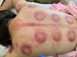 -芳朵美容养生SPA