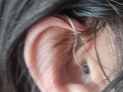 -北京悦听品牌助听器集合店峰力奥迪康斯达克瑞声达(石景山店)