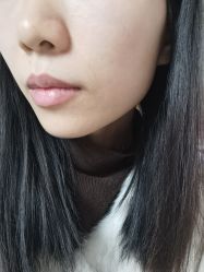 -长沙雅美医疗美容医院