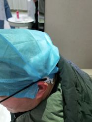 -大麦微针植发全国连锁