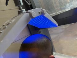 -碧莲盛·不剃发植发