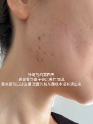 体验后-演员的秘密·皮肤管理