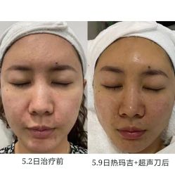 -上海伊莱美医疗美容医院