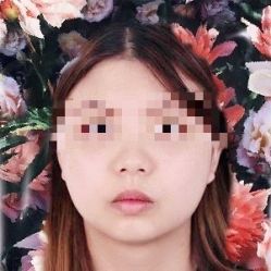 体验前-和颜一美轻医美连锁