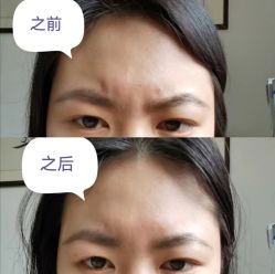 体验前-哈尔滨瑞丽医疗美容医院