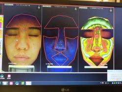 皮肤检测-光SPA科技美肤