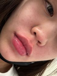 -海涛医疗美容·面部抗衰·注射美鼻