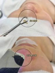 -LUNA皮相美·骨相美高级美感
