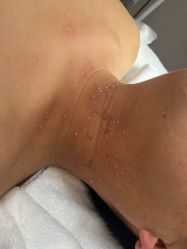 -清疣美疣·痣·斑净肤中心