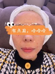 体验后-深圳美莱医疗美容医院