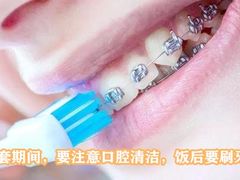 -团圆口腔·种植中心(锦江院区)