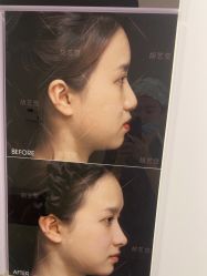 -长沙雅美医疗美容医院