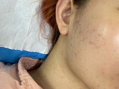 -中国医学科学院皮肤病医院