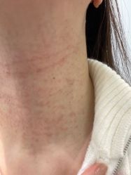 -agge蛋白医美