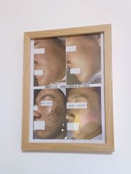 -美肤盾祛痘·问题肌头疗管理中心