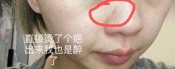体验后-安琪儿医疗美容中心