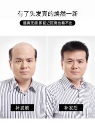 -唐风采假发补发定制