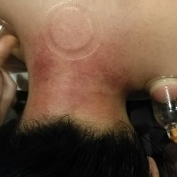 -升艾堂亚健康调理中心