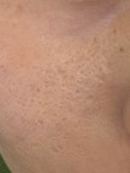 体验前-亿美医疗美容·半岛大超炮官方授权店