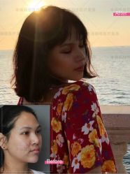 -北京米扬丽格医疗美容·联合丽格鼻整形中心