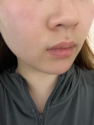 -广州美莱医疗美容医院