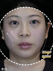 -Yestar重庆艺星医疗美容医院