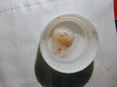 -上海仁爱医院口腔科 · 种植