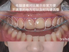 -爱雅仕口腔·数字化矫正中心(国贸门诊)