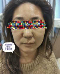 -圣嘉新医疗美容医院