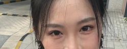 -美安心医美·美迪迈黄金微针·美拉美医疗美容