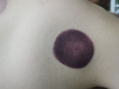 -安琪盲人按摩调理草本熏蒸馆(风和日丽店)