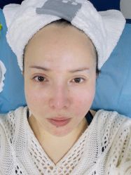 体验前-哈尔滨瑞丽医疗美容医院