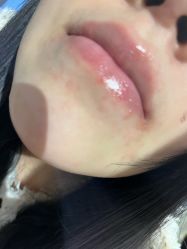 -More摩尔医美の注射线雕光电中心