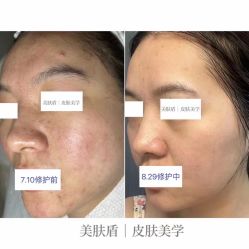 -美肤盾祛痘·问题肌头疗管理中心