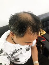 -发饰美男士增发补发假发定制店