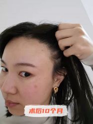 -雍禾植发全国连锁