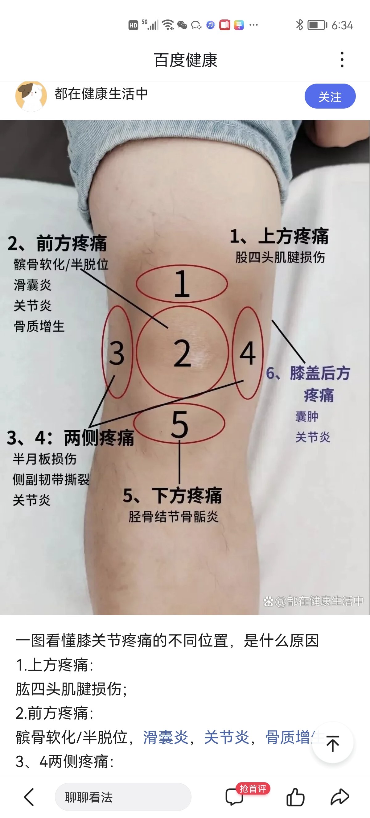 膝盖疼痛对照图图片