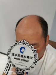 -唐风采假发补发定制