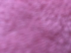 -滆湖低碳生态公园