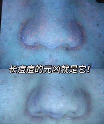 -+MS卓美丝专业祛痘·皮肤管理中心