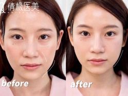 -倩极·精研痘敏肌管理
